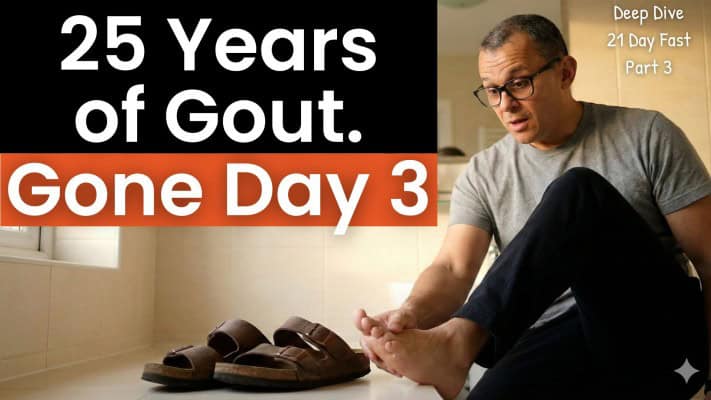 Man examining foot after extended fast refeed showing gout crystal reduction